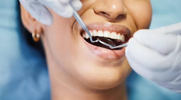 Best Emergency Treatment for Dental Infections or Abscesses in Morrow, OH