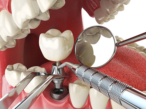 Best Emergency TMJ Treatment in Morrow, OH